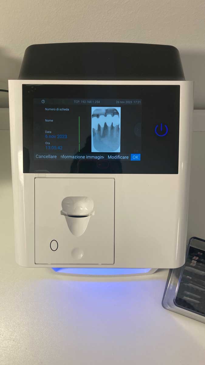 radiografia digitale studio dentistico marta petri biella